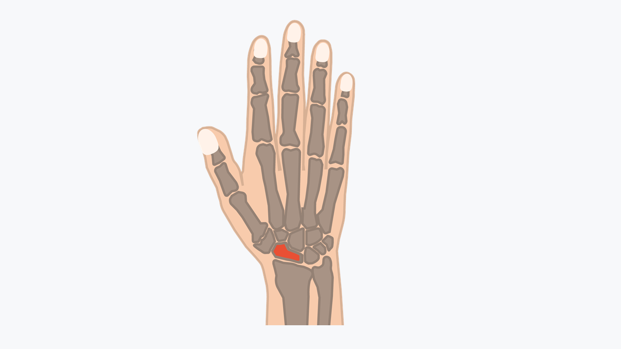 LM1 MK D Hand mit Knochen Kahnbein hervorgehoben Blog 01 DE