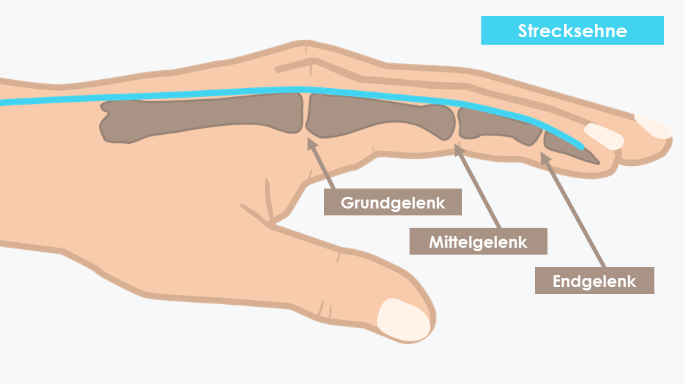 Strecksehnen (blau) verlaufen entlang der Fingerknochen und bedecken Grund-, Mittel- und Endgelenk.